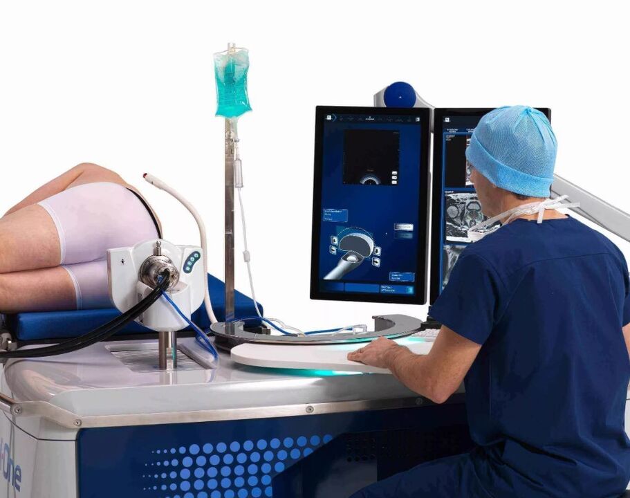 Ultrasound examination of prostate gland